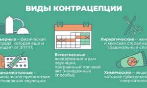 Какие есть средства предохранения для женщин: их преимущества и недостатки в современном мире