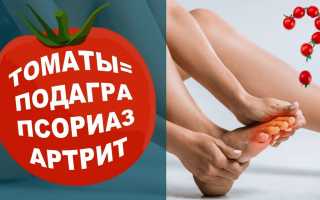 Подагра и помидоры: совместимы или нет? Узнайте мнение врачей