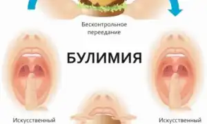 Нервная булимия: что это такое и как с ней бороться?