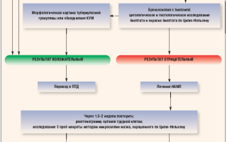 Как проходит диагностика разных форм туберкулеза? Полное руководство