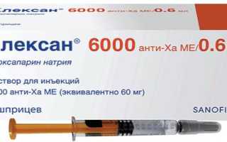 Эноксапарин (Клексан) при беременности: когда назначают, как использовать и возможные риски
