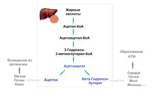 Почему пот пахнет ацетоном? Что делать в этой ситуации?