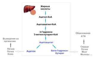 Почему пот пахнет ацетоном? Что делать в этой ситуации?