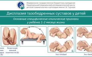 Вывих (дисплазия) тазобедренного сустава у новорожденных: причины, лечение и профилактика