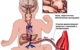 Как может случиться внутриутробная гипоксия плода и чем это грозит для здоровья