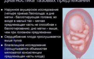 Предлежание на 20 неделе