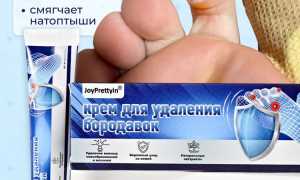 Чем лечить мозоли на ногах: обзор домашних средств и мазей для эффективного ухода
