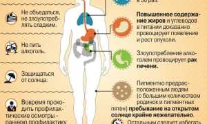 Рак: причины болезни, лечение и профилактика