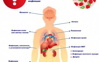 Чем опасен сепсис при COVID-19: последствия, лечение и профилактика