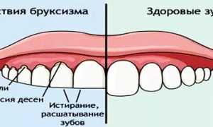 Почему человек скрипит зубами во сне? Узнайте причины и последствия.