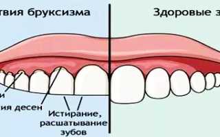 Почему человек скрипит зубами во сне? Узнайте причины и последствия.