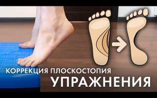 Как исправить плоскостопие взрослому: полезные упражнения для здоровья