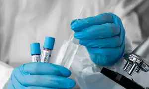 COVID-19 может провоцировать диабет, считают ученые, новые исследования