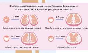 Как понять, что у вас двойня на раннем сроке беременности. Основные признаки и советы