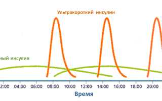 Как колоть болюсный инсулин: методы расчета дозировок для диабетиков