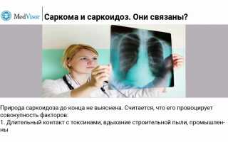 Почему путают саркому и саркоидоз, и как они связаны? Обзор и анализ