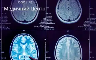 Что такое микроангиопатия головного мозга (церебральная) и как её лечить: причины и симптомы