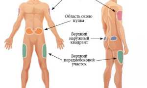 Как ставить инсулин, правильная техника для диабетиков