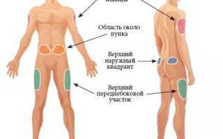 Как ставить инсулин, правильная техника для диабетиков