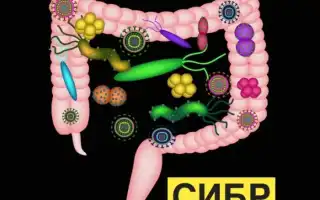 СИБР в кишечнике — что это значит и как его лечить? Полезные советы