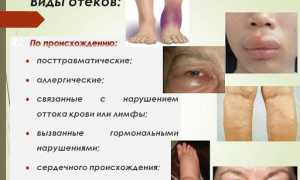Почки и отеки: как они связаны, отличия от других видов отеков и их лечение