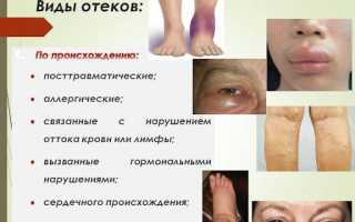 Почки и отеки: как они связаны, отличия от других видов отеков и их лечение
