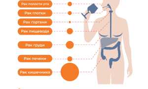 Вызывает ли алкоголь рак? Влияние на здоровье