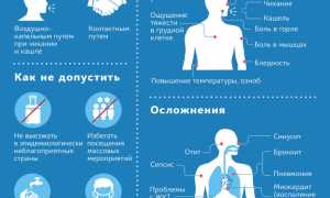 COVID-19 и его возможные признаки: что нужно знать