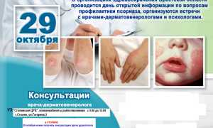 Лечение псориаза летом: основные советы для здоровья кожи