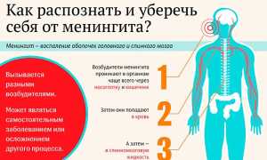 Что такое бактериальный менингит и его последствия?