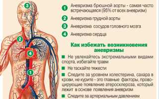 Найти аневризму: внешние признаки и симптомы у пациентов