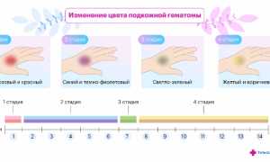 О чем говорят синяки на теле? Важные аспекты здоровья