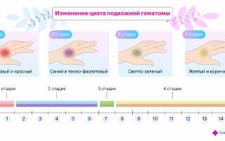О чем говорят синяки на теле? Важные аспекты здоровья