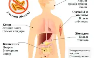 Что такое целиакия? Узнайте больше о заболевании.