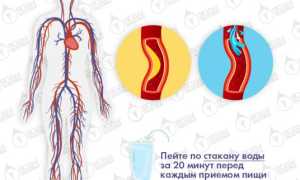 Как понизить холестерин и сахар в крови? Рекомендации специалистов для здоровья