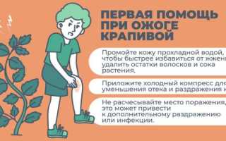 Крапивный ожог и как его лечить правильно