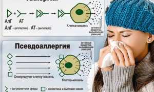 Псевдоаллергические реакции: чем они отличаются от аллергии и как их распознать?