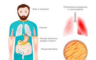 Болезнь легионеров: почему она опаснее обычной пневмонии и как её избежать