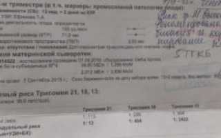 Анализы на патологию при беременности