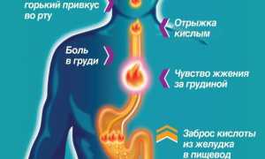 Изжога от алкоголя: почему бывает, как от нее избавиться и предотвратить