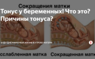 Не проходит тонус матки при беременности что делать