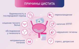 Рецидивы цистита: почему они случаются и как с этим бороться?