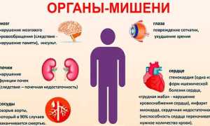 Это гипертония: к какому врачу обратиться по поводу высокого давления и его лечения?