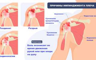 Слабость и боль в плечах: разбираемся, в чем причина и как помочь