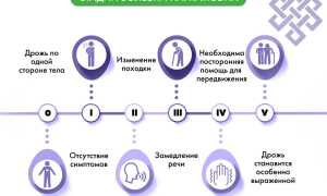 Как развивается болезнь Паркинсона: стадии и длительность заболевания
