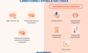 Вирус герпеса: симптомы и лечение, важные аспекты