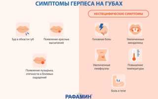 Вирус герпеса: симптомы и лечение, важные аспекты