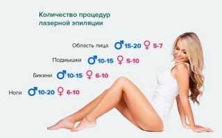 Лазерная эпиляция: когда стоит начинать курс процедур