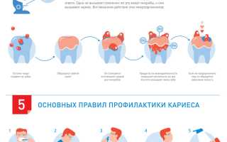 Как предотвратить кариес? Полезные советы и рекомендации