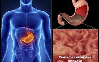 Аллергический гастрит: симптомы и лечение, советы специалистов
